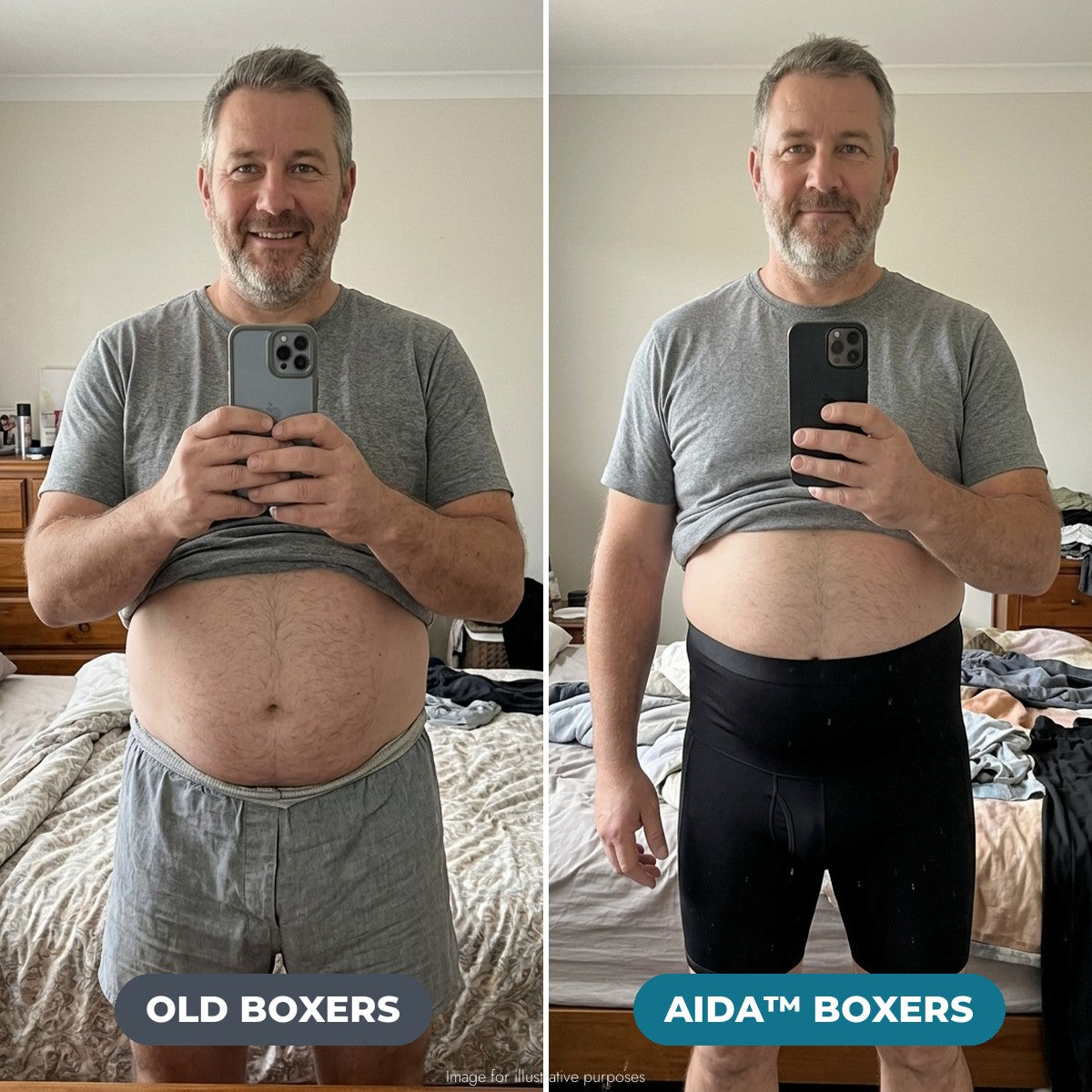 Aida Lymphatic Support Boxers - Before and After
